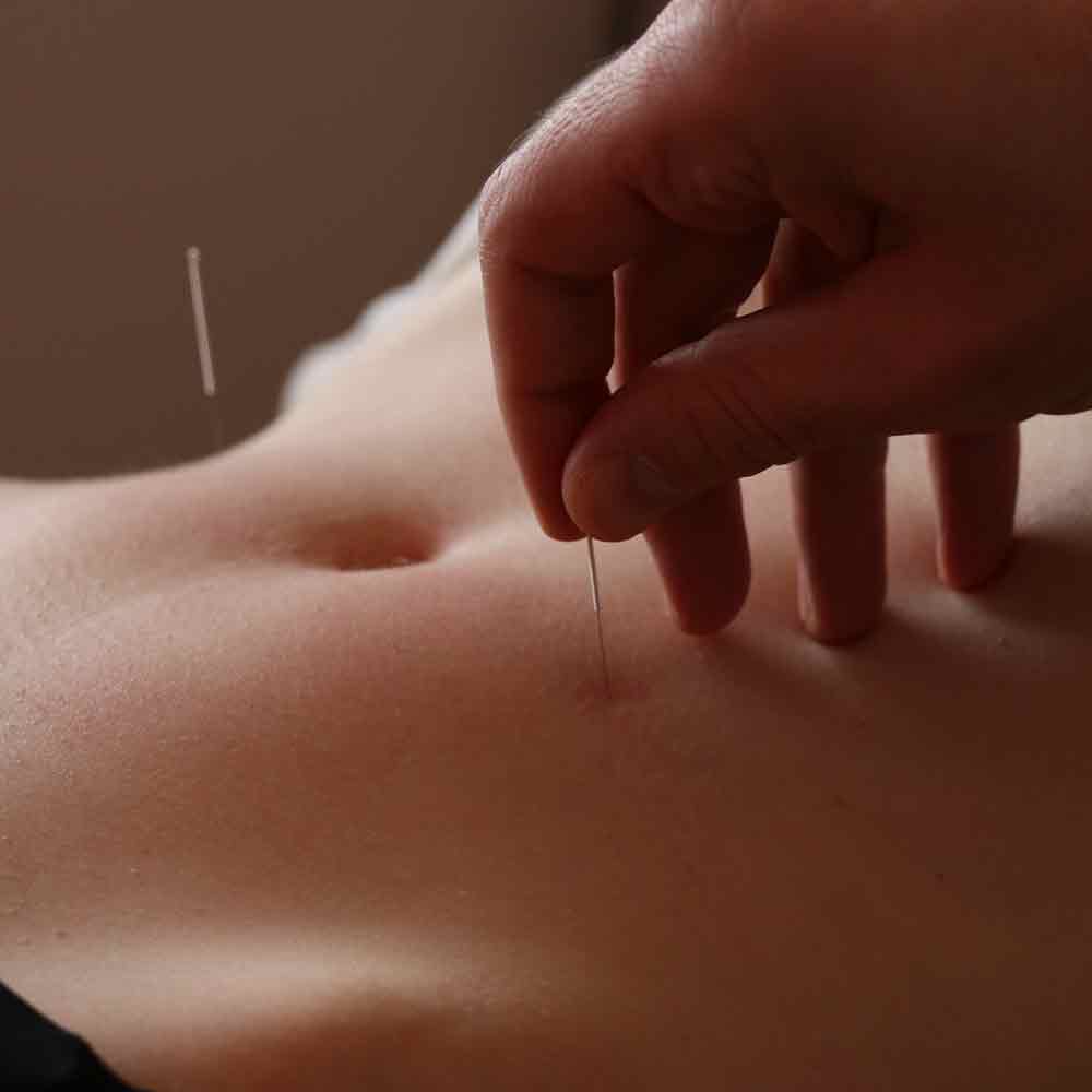 acupuncture medecine chinoise toulouse